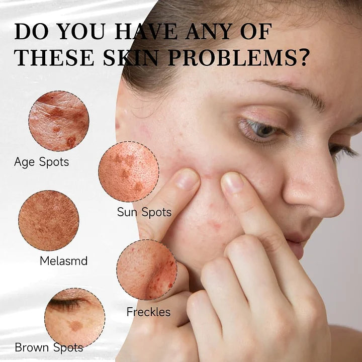 Facial and body spot-removing essence